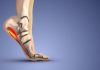 The Warning Patterns Foot Specialists Notice in Advanced Plantar Fasciitis early plantar fasciitis